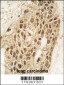 Dnmt3a Antibody (N-term R46)